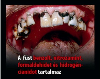 Dohányoznál ? 🙁