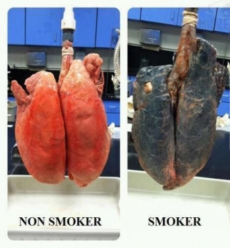 Egyszer élünk . . .