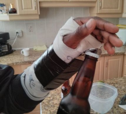 Történt egy kis baleset . . . 