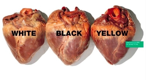 Antirasszista kampány - jól csinálod