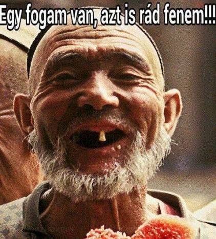 Üzent a fogtündér