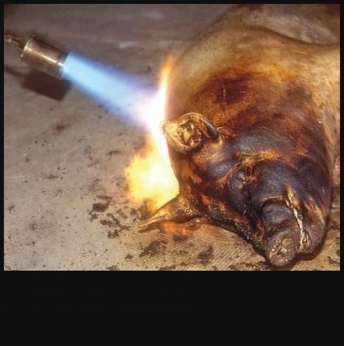 Végleges szőrtelenítés