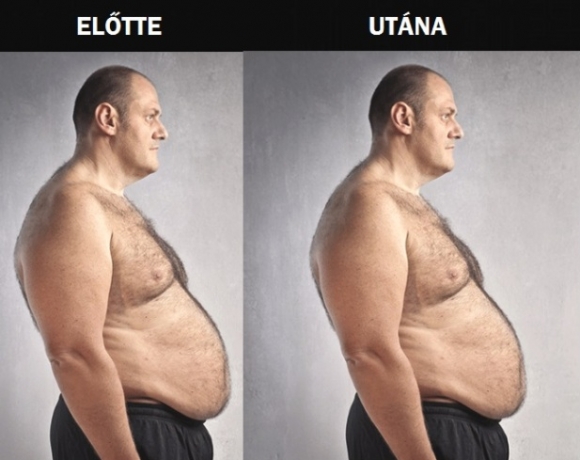 Béla zsírégető teát ivott, és mindössze...