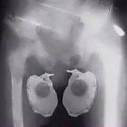 A mai hőség első két áldozata