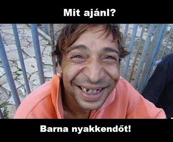 Doktor úr, nagyon sárgák a fogaim...