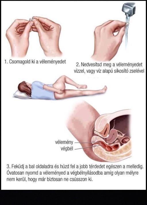 Útmutató, hogy mit csinálj a véleményeddel
