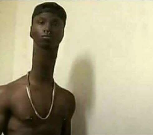 Amikor bekapsz egy Viagrát, és a torkodon akad