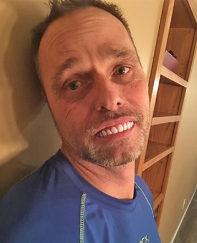 Apám rendelt magának a netről egy műfogsort