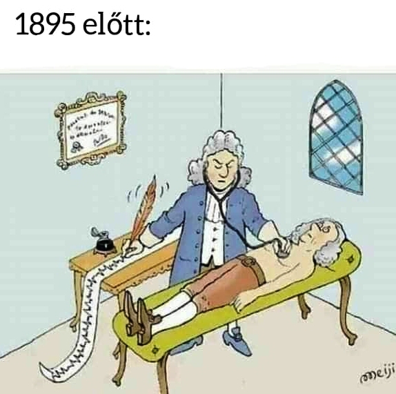 Tudtad? - Az EKG-t 1895-ben találták fel